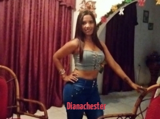 Dianachester